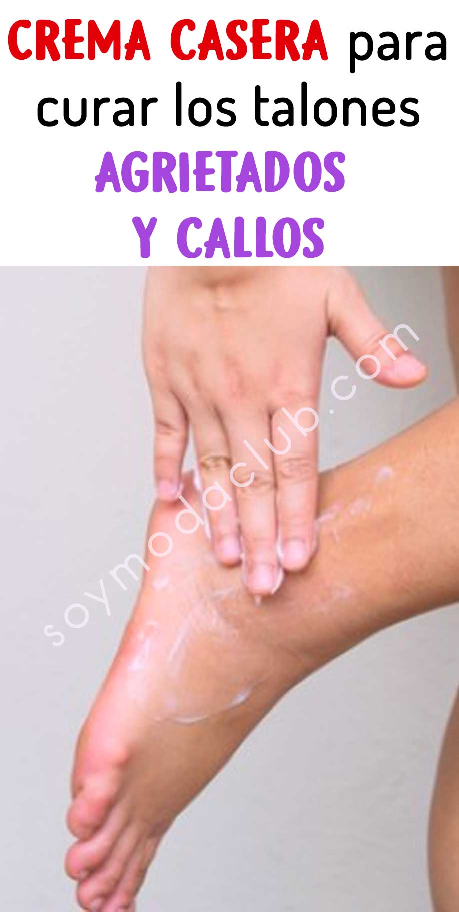 Remedio Casero Para Curar Los Talones Agrietados Y Callos Soy Moda